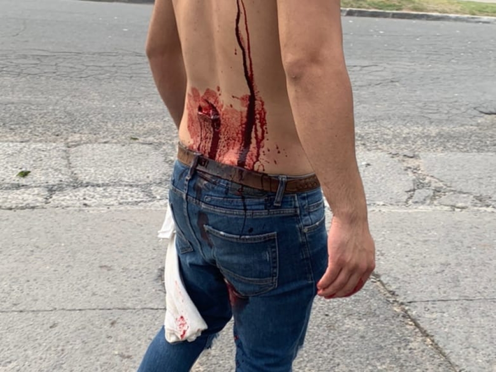 Medina asegur&oacute; que le dieron 27 puntos de sutura. 