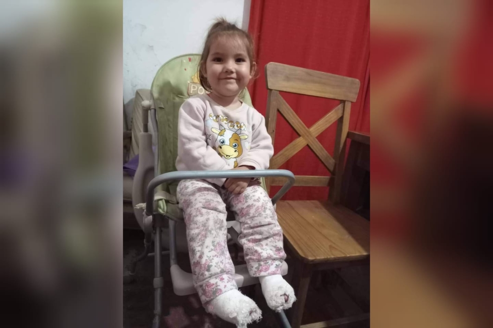 Isabella, con los dos pies enyesados. 