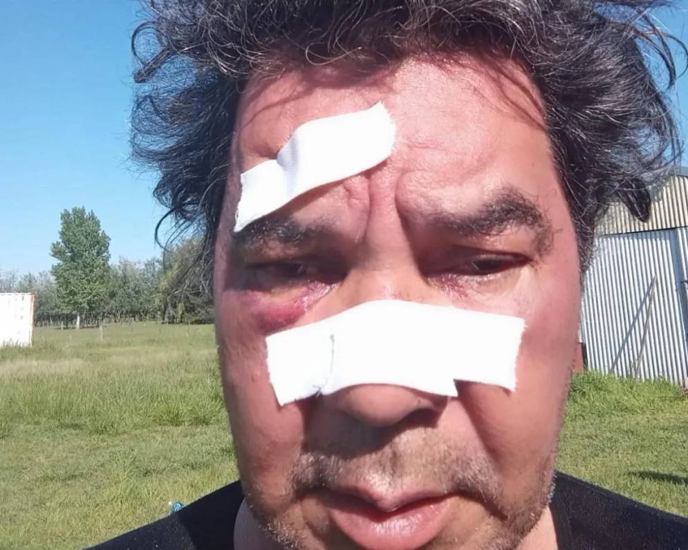 Problem&aacute;tico. A fines de 2024 fue golpeado por un automovilista en el centro de Ca&ntilde;uelas.