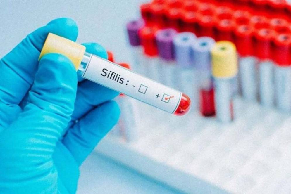 Es una valorable pol&iacute;tica de salud p&uacute;blica.