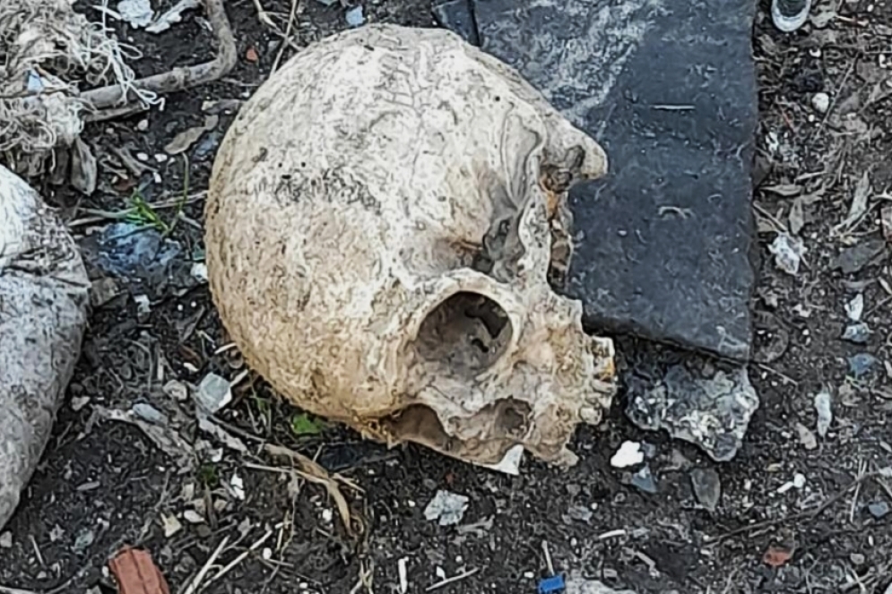 Restos de un cr&aacute;neo y piezas dentales. (Imagen ilustrativa).