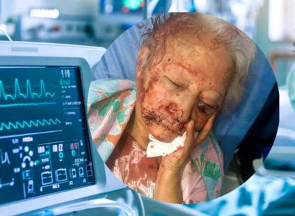 El cr&iacute;tico estado de salud de la abuela golpeada en el robo de Los Aromos