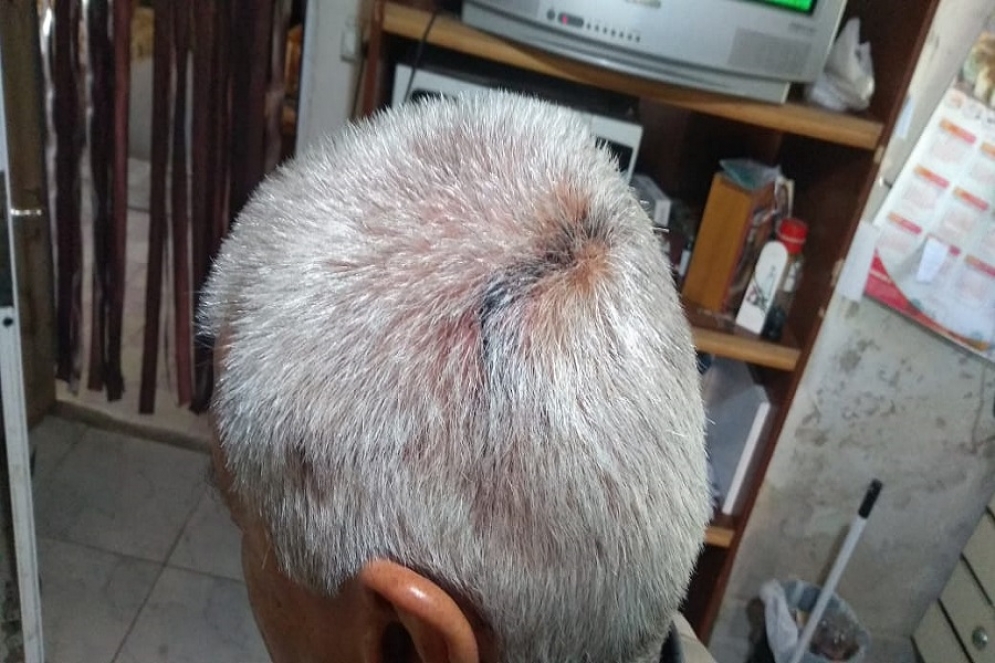 Ocurri&oacute; el domingo  a la noche