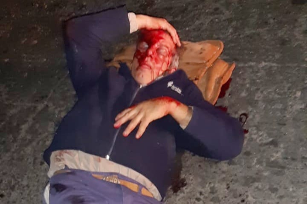 La oscuridad de la zona gener&oacute; temor entre los lugare&ntilde;os que se acercaron a dar auxilio.