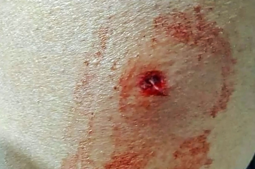 Se dirig&iacute;a por la calle Braille cuando sinti&oacute; un fuerte dolor en su pierna izquierda. 