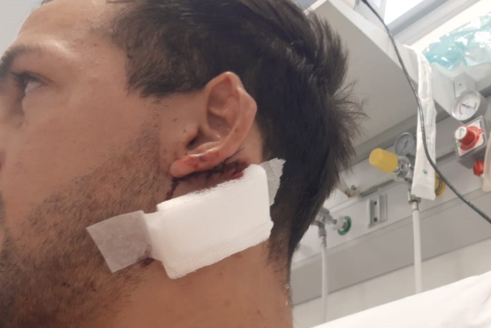 El corte habr&iacute;a sido originado con un elemento filoso, pero no con un cuchillo. 